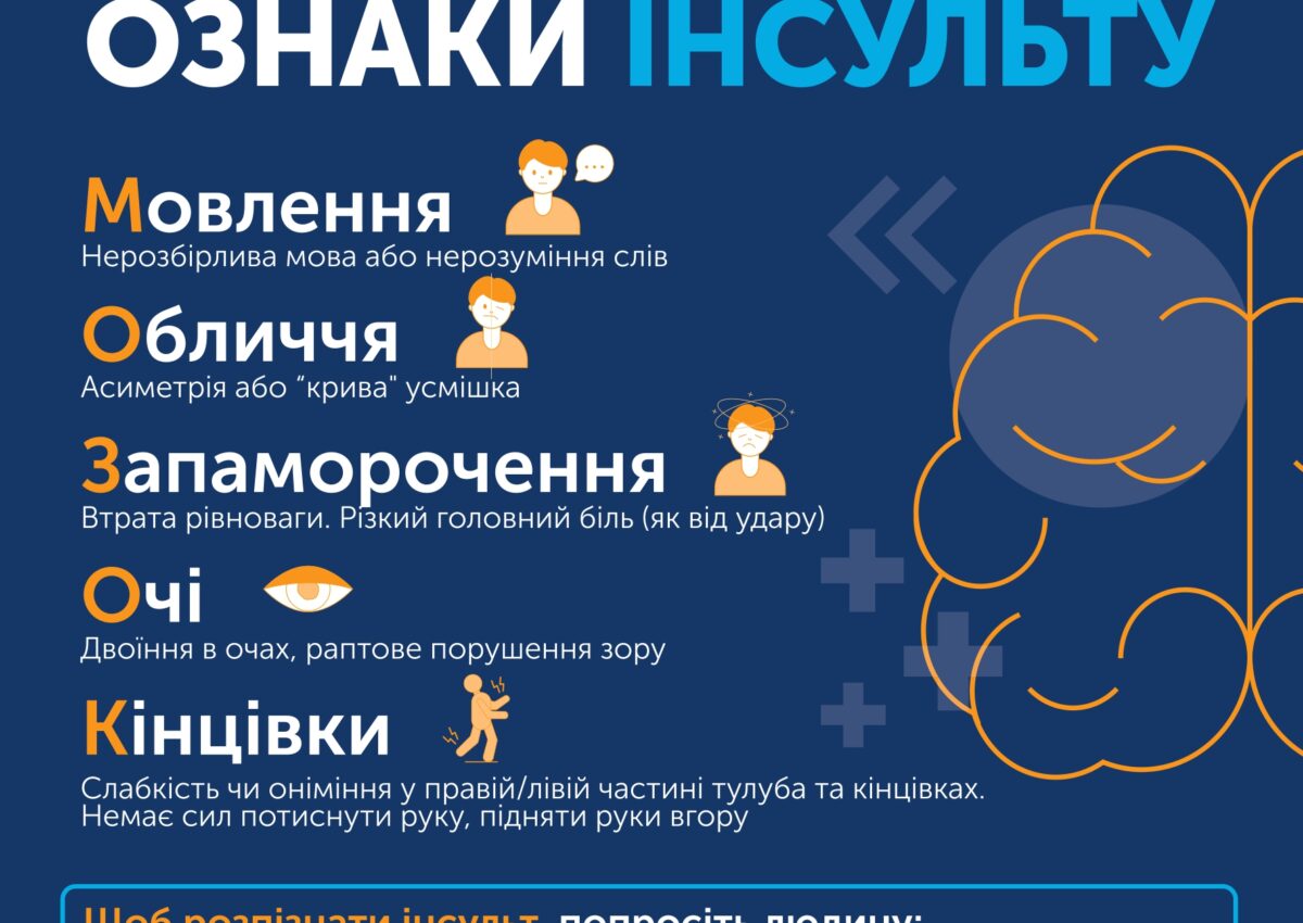 Знай ознаки інсульту